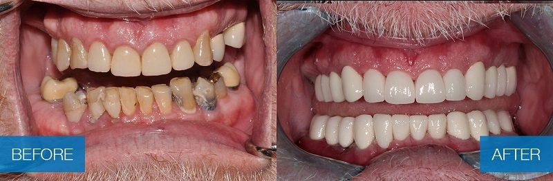 bagatin-teeth.jpg