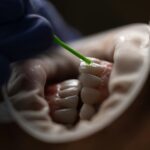 new dental treatment rules croatia