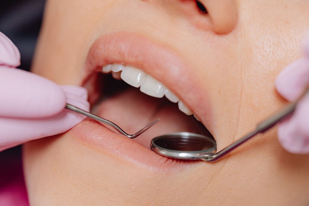 dentistry croatian health insurance